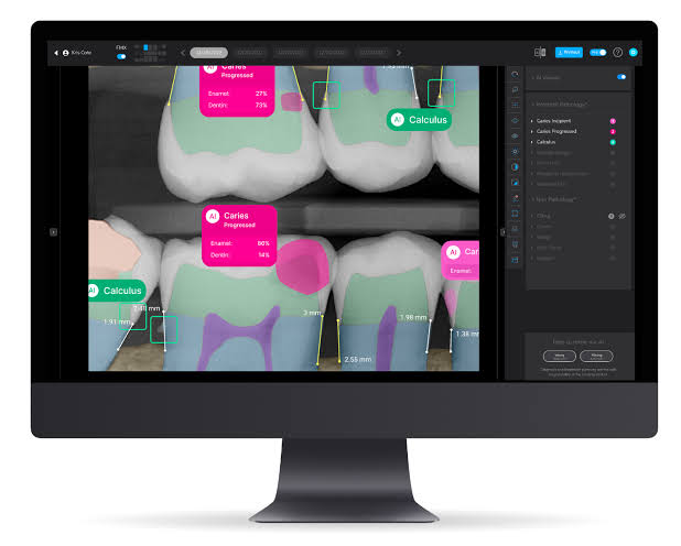 AI in Dentistry: How Artificial Intelligence Is Changing Dental Care
