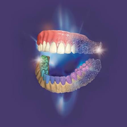 Same-day crowns with in-house CAD/CAM
