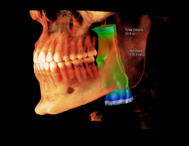 3D CBCT imaging for precise diagnostics